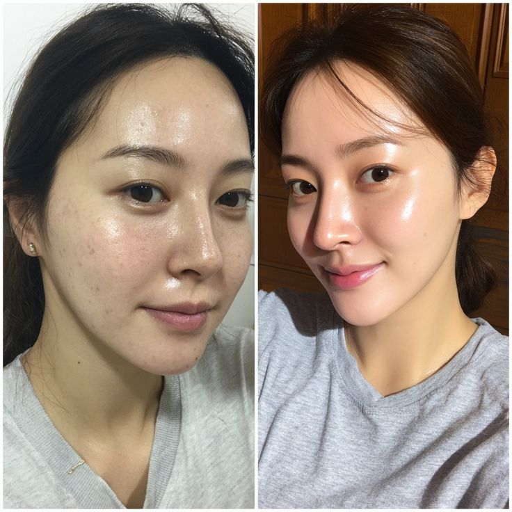 Madaga Tone Brightening Capsule Amp 30ml