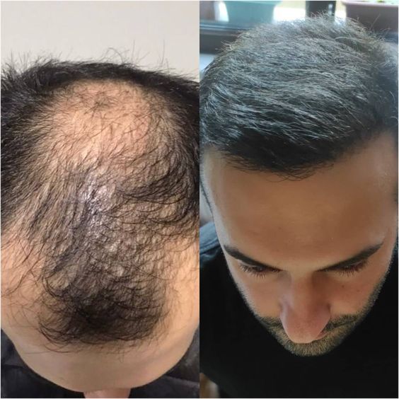 ELOHE Tónico Revitalizante para el Crecimiento Capilar