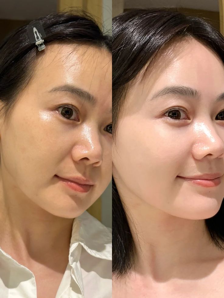 Madaga Tone Brightening Capsule Amp 30ml