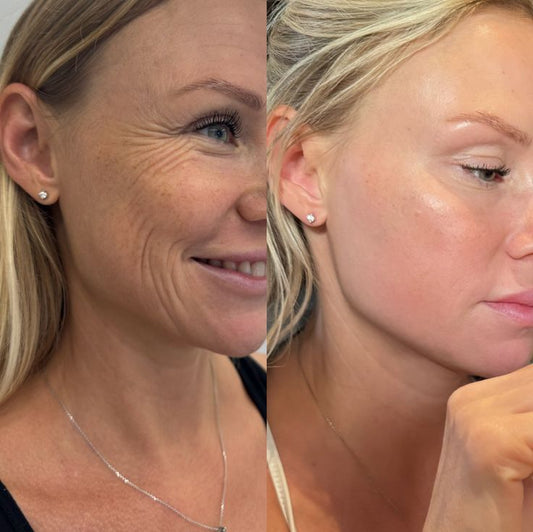 Resultados del serum facial antiarrugas premium mostrando eliminación de arrugas y una piel más luminosa y rejuvenecida.