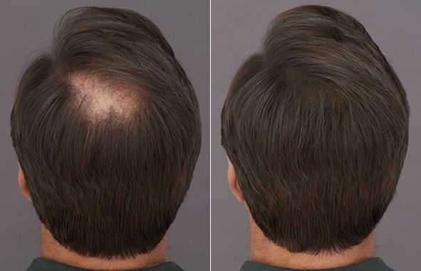 ELOHE Tónico Revitalizante para el Crecimiento Capilar